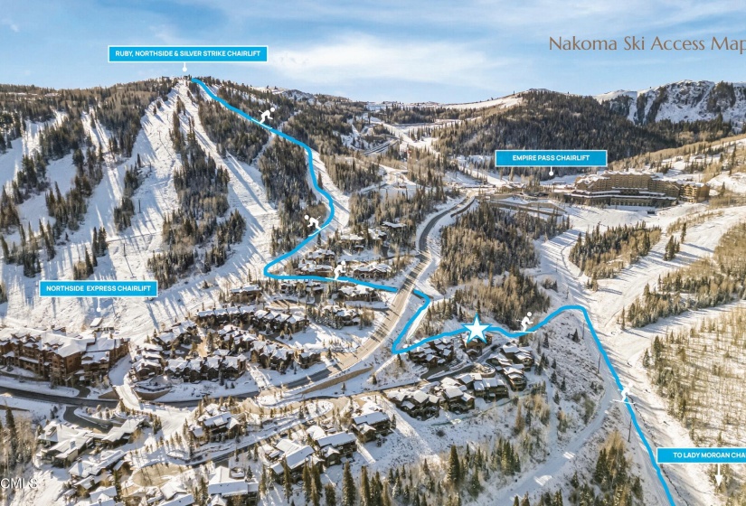 Nakoma Ski Access